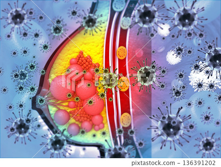 Virus  cause Breast cancer concept background 136391202