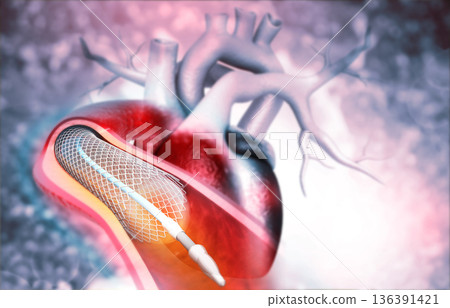 Human heart angioplasty 136391421