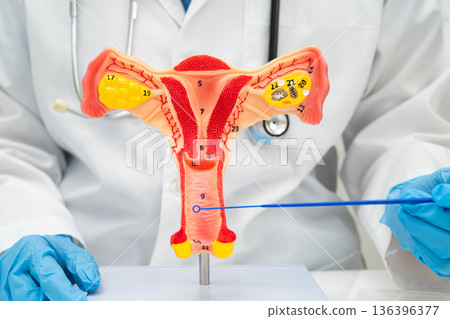 Doctor holding human uterus model for vaginal and cervix pap smear check up in the obstetrics and gynecology. 136396377