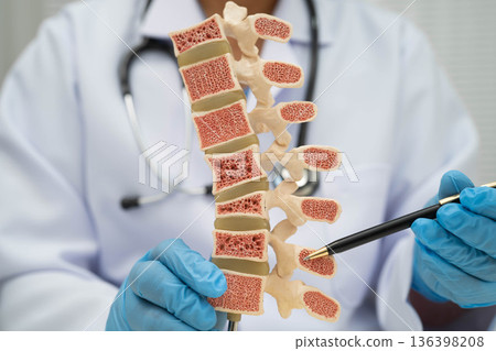 Doctor holding osteoporosis in back bone model for treatment medical. Doctor holding osteoporosis in back bone model for treatment medical. 136398208