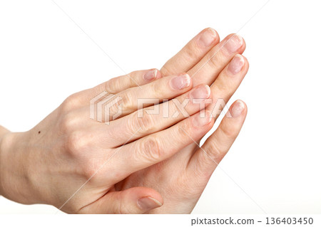 Damaged fingernails after gel polish removal Damaged fingernails after gel polish removal 136403450