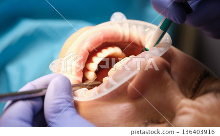 Dentist examines teeth with precision tools during a routine check-up in a modern clinic setting 136403916