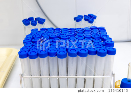 Laboratory sample tubes with blue caps in rack on workbench Laboratory sample tubes with blue caps in rack on workbench 136410143