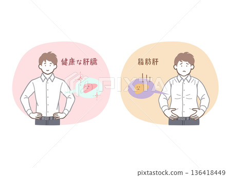 一組插圖，描繪了一位擁有健康肝臟和脂肪肝的男士 136418449