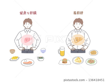 Illustration set of a man with a healthy liver and fatty liver Illustration set of a man with a healthy liver and fatty liver 136418451