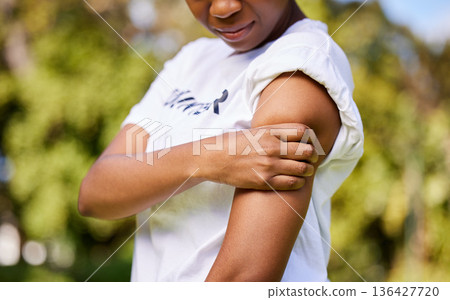 Woman, arm injury and pain in nature from accident, tension or outdoor muscle cramp. Closeup of female person or volunteer worker with sore ache, discomfort or joint inflammation in nature Woman, arm injury and pain in nature from accident, tension or outdoor muscle cramp. Closeup of female person or volunteer worker with sore ache, discomfort or joint inflammation in nature 136427720