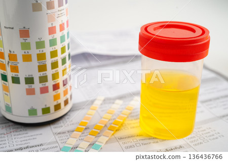 Urinalysis, urine cup with reagent strip pH paper test and comparison chart in laboratory. 136436766