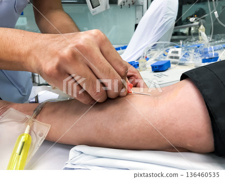Blood platelet donation, a male nurse inserts a needle into donor arm to draw blood at a hospital. Blood platelet donation, a male nurse inserts a needle into donor arm to draw blood at a hospital. 136460535