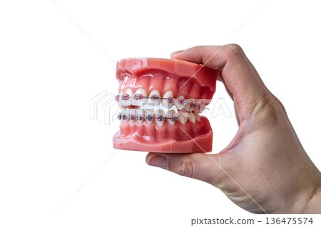 Hand holding dental teeth model with metal braces, perfect for orthodontic education, dentist offices, and smile makeover concepts Hand holding dental teeth model with metal braces, perfect for orthodontic education, dentist offices, and smile makeover concepts 136475574