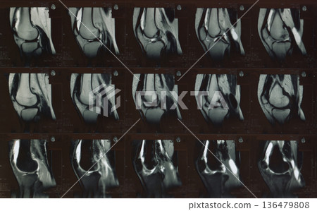 MRI scan showing multiple cross section images of knee joint in radiology film. Concept of medical diagnostics, MRI imaging technology, orthopedic examination, healthcare research 136479808