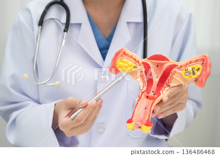 Uterus, doctor holding human anatomy model for study diagnosis and treatment in hospital. Uterus, doctor holding human anatomy model for study diagnosis and treatment in hospital. 136486468
