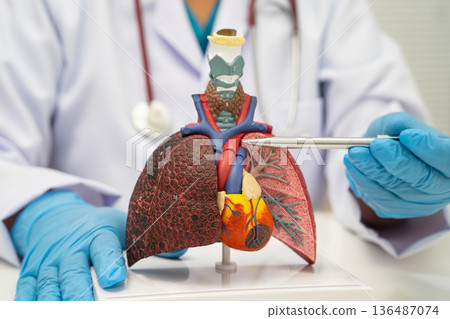 Pneumonia, lung cancer, Asian doctor holding human anatomy model for study diagnosis and treatment in hospital. 136487074