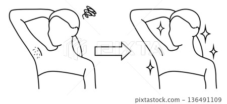 線條畫插圖,描繪了女性腋毛去除前後的對比。 線條畫插圖,描繪了女性腋毛去除前後的對比。 136491109