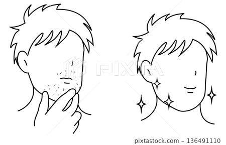 男士鬍鬚去除術－前後對比線描圖 136491110