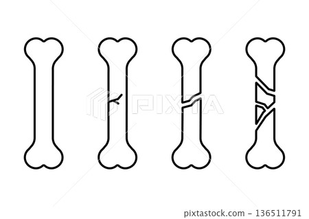 A set of bone icons showing various fractures 136511791