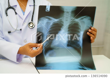Doctor examining lung radiography xray film. 136514090