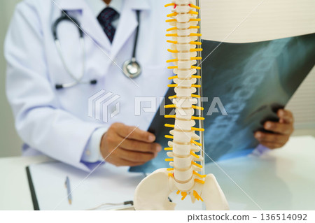 Doctor examining spine bone radiography xray film. Doctor examining spine bone radiography xray film. 136514092