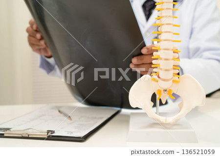 Doctor examining spine bone radiography xray film. 136521059