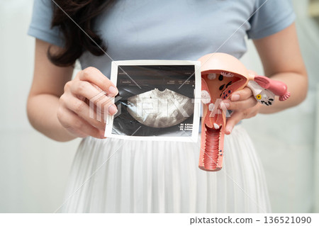 Uterus ultrasound, Asian woman holding human anatomy model. Uterus ultrasound, Asian woman holding human anatomy model. 136521090