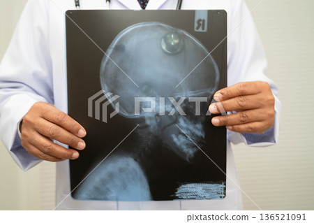 Doctor examining brain radiography xray film. Doctor examining brain radiography xray film. 136521091