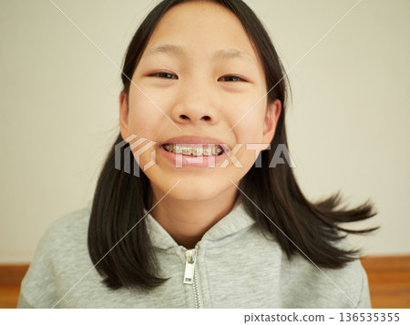 The face of a female junior high school student undergoing orthodontic treatment 136535355