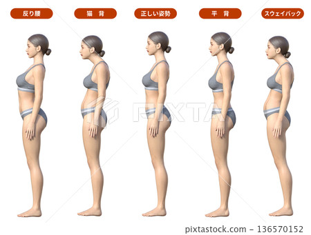 Comparison of postures: Swayback, arched back, forward tilt of the pelvis, hunchback, flat back, correct posture illustration, whole body sideways 136570152