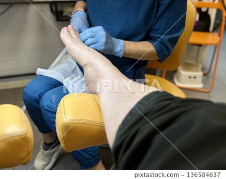 Hardware medical pedicure using a drill and nail files. A patient has a pedicure at a podiatrist. A dangerous fungal lesion of human toenails. Onychomycosis, treatment of nail fungus. 136584637
