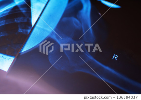 Assessment of prosthetic positioning and bone health during postoperative examination process Assessment of prosthetic positioning and bone health during postoperative examination process 136594037