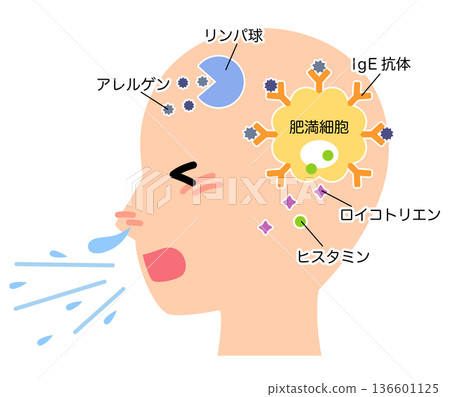 How allergies develop: The mechanism of hay fever How allergies develop: The mechanism of hay fever 136601125