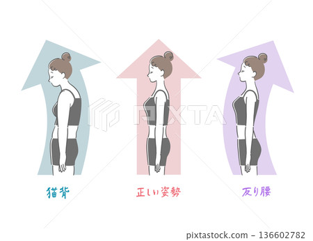 正確姿勢、駝背和拱背女性的對比插圖 正確姿勢、駝背和拱背女性的對比插圖 136602782