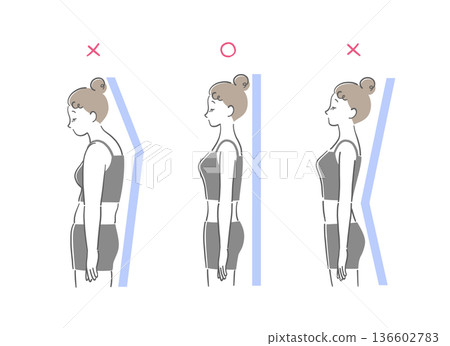 Comparison illustration set of correct posture, hunchback and arched back women Comparison illustration set of correct posture, hunchback and arched back women 136602783