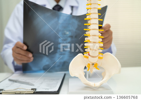 Doctor examining spine bone radiography xray film. 136605768