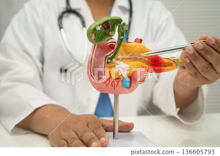 Pancreatitis, pancreatic cancer, Asian doctor with pancreas, gallbladder and bile duct human anatomy model at hospital. 136605793