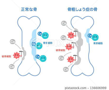 Mechanisms of bone resorption and bone formation: Normal bones and osteoporotic bones Mechanisms of bone resorption and bone formation: Normal bones and osteoporotic bones 136606999