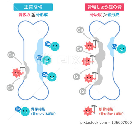 Mechanisms of bone resorption and bone formation: Normal bones and osteoporotic bones 136607000