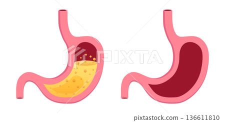 Gerd stomach icon in flat style. Reflux vector illustration on isolated background. Esophageal organ sign business concept. 136611810