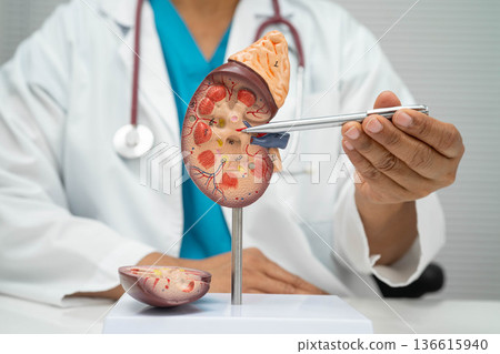 Chronic kidney disease, Asian woman with model for treatment urinary system, urology, Estimated glomerular filtration rate eGFR. Chronic kidney disease, Asian woman with model for treatment urinary system, urology, Estimated glomerular filtration rate eGFR. 136615940