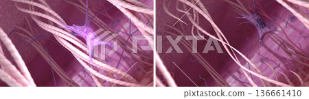 Simile of the fibroblasts, collagen, and elastin fibers in young and aged skin. 3D illustration 136661410