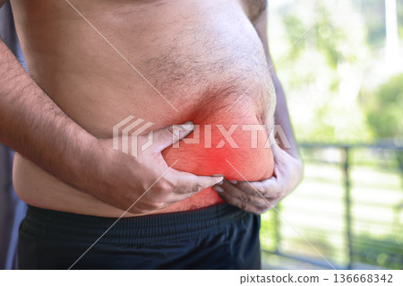 Overweight Asian man holding fat belly suffering from abdominal pain with red inflamed area. Concept of stomach ache, indigestion, gastritis, liver problem, and obesity healthcare issues. Overweight Asian man holding fat belly suffering from abdominal pain with red inflamed area. Concept of stomach ache, indigestion, gastritis, liver problem, and obesity healthcare issues. 136668342