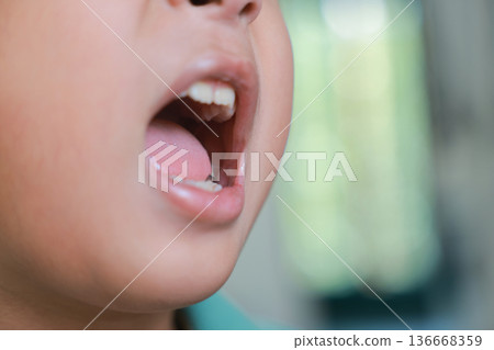 Close up of child's open mouth showing teeth and tongue, Asian boy having dental checkup, sore throat, oral health problem, tonsillitis or throat infection symptoms. 136668359