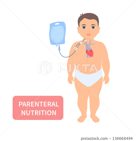 Child receiving parenteral nutrition through a central intravenous access Child receiving parenteral nutrition through a central intravenous access 136668494