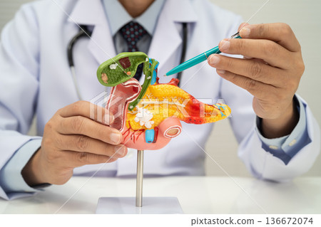 Pancreatitis, pancreatic cancer, Asian doctor with pancreas, gallbladder and bile duct human model. Pancreatitis, pancreatic cancer, Asian doctor with pancreas, gallbladder and bile duct human model. 136672074