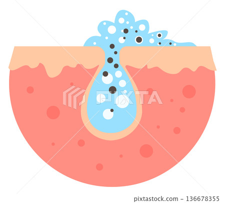 Skin pore cleansing illustration. Unclog deep sebum Skin pore cleansing illustration. Unclog deep sebum 136678355
