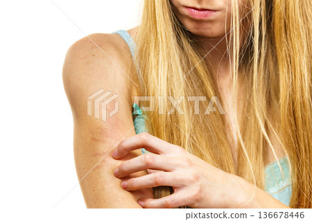 Woman scratching her itchy arm. Skin allergy. Woman scratching her itchy arm. Skin allergy. 136678446
