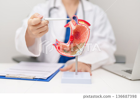 Doctor with Gastric anatomy model. Gastroenterologist consultation, stomach diseases and ulcers, November stomach cancer, Gastroesophageal Reflux Disease, GERD, Acid reflux and healthcare medical 136687398
