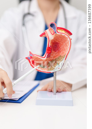 Doctor with Gastric anatomy model. Gastroenterologist consultation, stomach diseases and ulcers, November stomach cancer, Gastroesophageal Reflux Disease, GERD, Acid reflux and healthcare medical 136687399