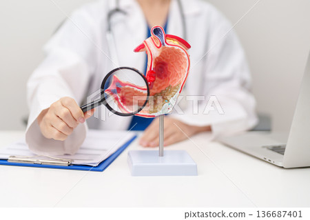 Doctor with Gastric anatomy model. Gastroenterologist consultation, stomach diseases and ulcers, November stomach cancer, Gastroesophageal Reflux Disease, GERD, Acid reflux and healthcare medical 136687401
