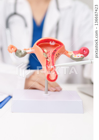 Doctor with Uterus and Ovaries anatomy model. Ovarian and Cervical cancer, Cervix disorder, Endometriosis, Hysterectomy, Uterine fibroids, Reproductive system, Pregnancy and health concept Doctor with Uterus and Ovaries anatomy model. Ovarian and Cervical cancer, Cervix disorder, Endometriosis, Hysterectomy, Uterine fibroids, Reproductive system, Pregnancy and health concept 136687423