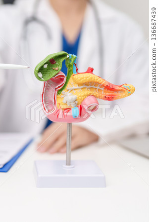 Doctor with human Pancreatitis anatomy model with Pancreas, Gallbladder, Bile Duct, Duodenum, Small intestine. Pancreatic cancer, Acute and Chronic pancreatitis, Digestive system and Health concept 136687439