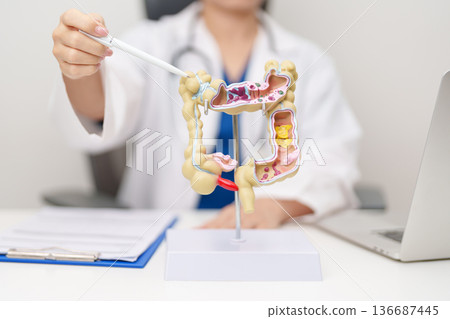 Doctor with human Colon anatomy model. Colonic disease, Large Intestine, Colorectal cancer, Ulcerative colitis, Diverticulitis, Irritable bowel syndrome, Digestive system and Healthcare concept 136687445